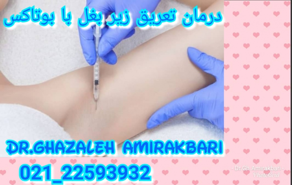 BOTOX injection in underarm